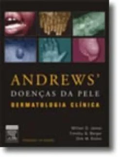 Andrews Doenças da Pele