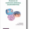 Avances en esclerosis sistémica (esclerodermia)