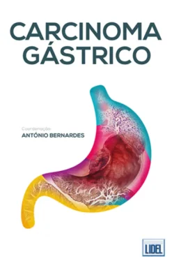 Carcinoma Gástrico