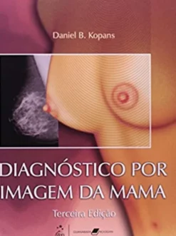 Diagnóstico por Imagem da Mama
