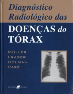 Diagnóstico Radiológico das Doenças do Tórax