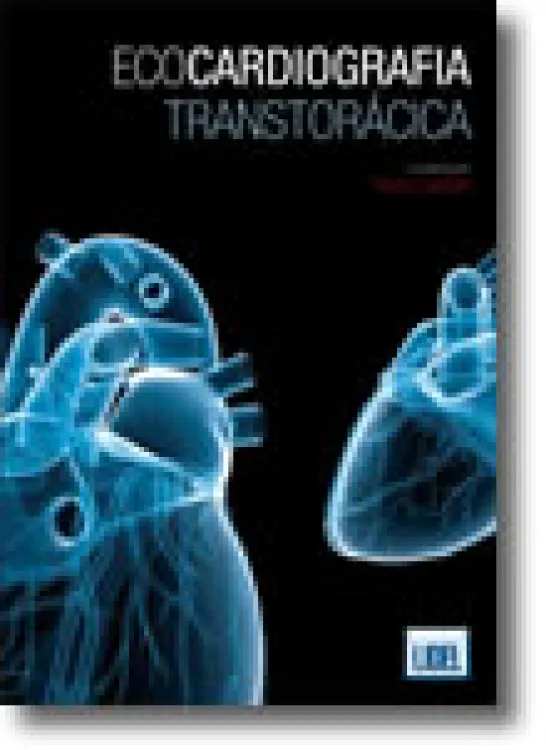 EcoCardiografia Transtorácica