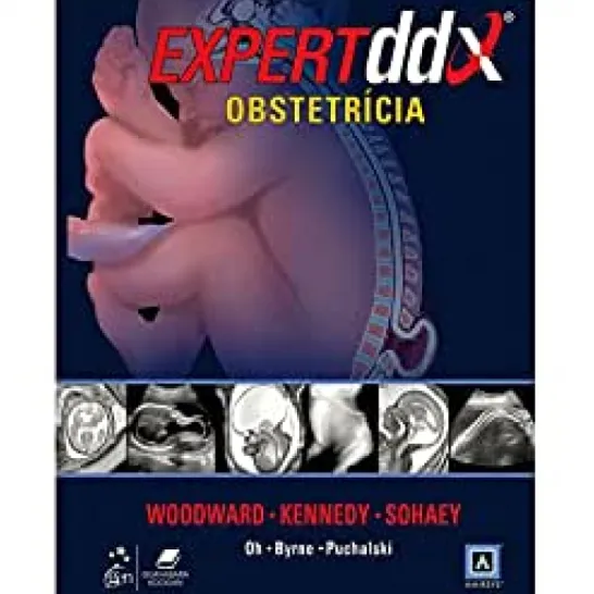 Expertddx - Obstetricia