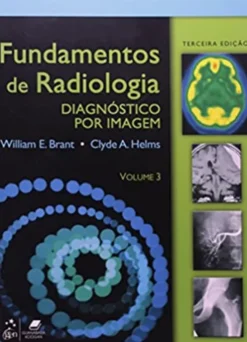 Fundamentos de Radiologia - Diagnóstico por Imagem
