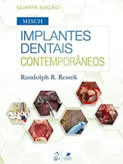 Misch - Implantes Dentais Contemporâneos