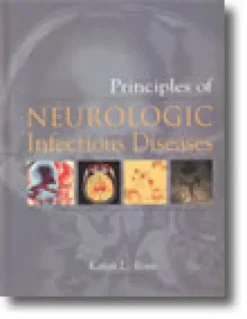 Principles of Neurologic Infectious Diseases