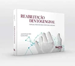 Reabilitação Dentogengival - Manual para Recriar Estruturas Naturais