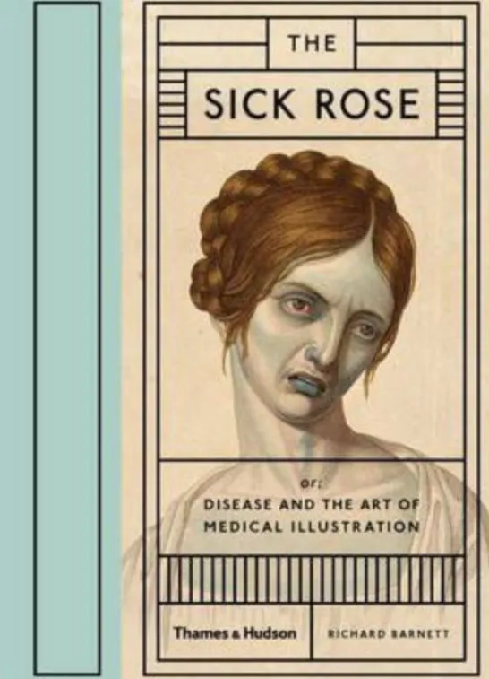 The Sick Rose