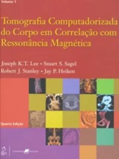 Tomografia Computadorizada do Corpo em Correlação com Ressonância Magnética