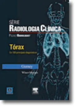 Tórax - Os 100 Principais Diagnósticos